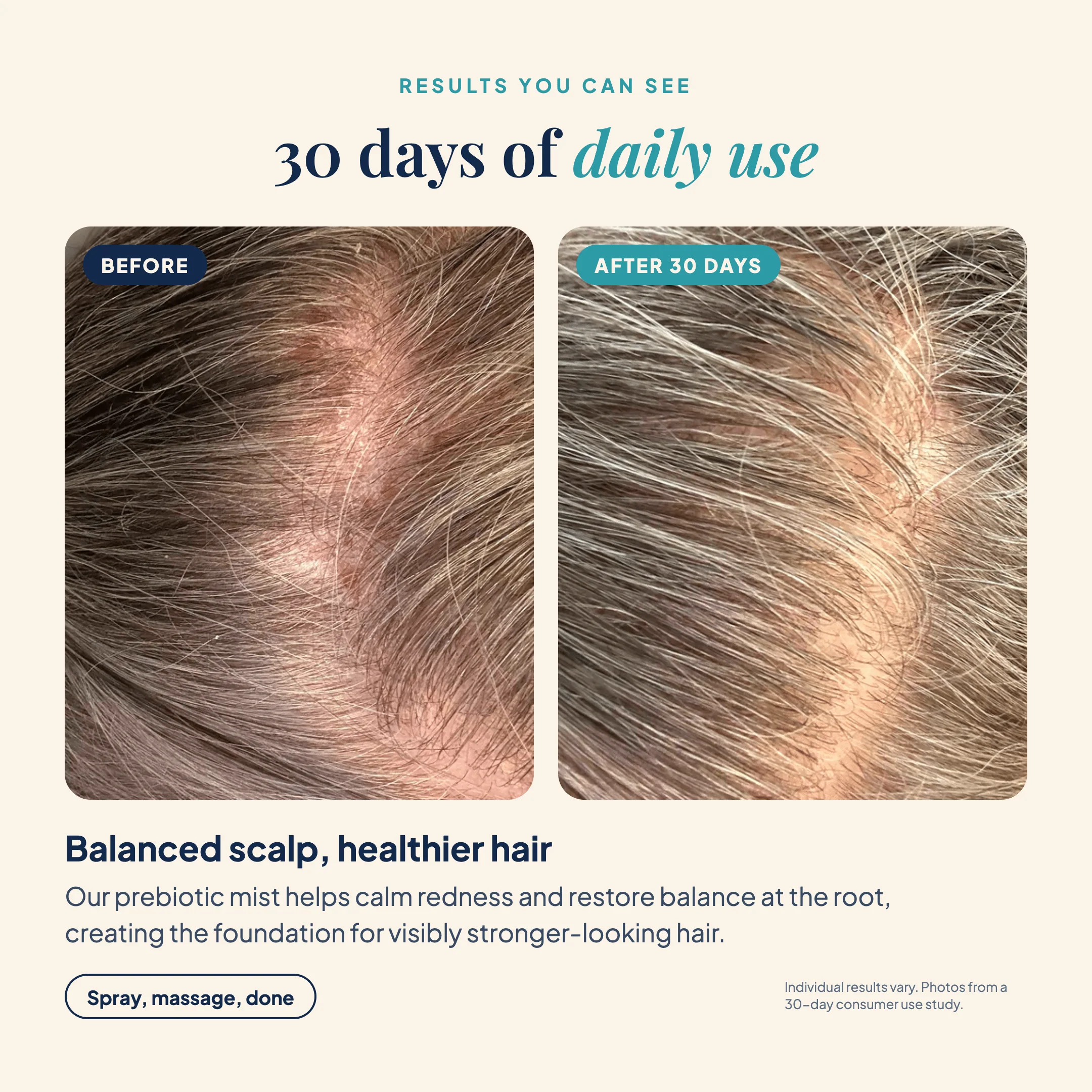GROW Nourishing Prebiotic Scalp Mist