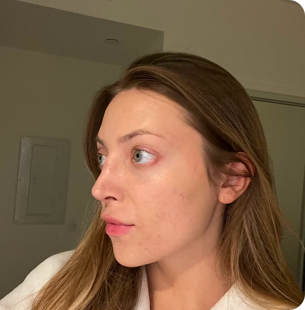 Calmer, More Even-Toned Skin
