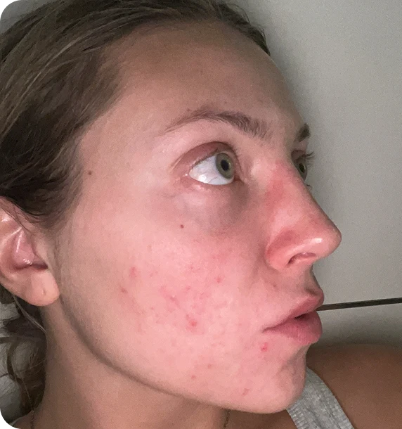 Calmer, More Even-Toned Skin